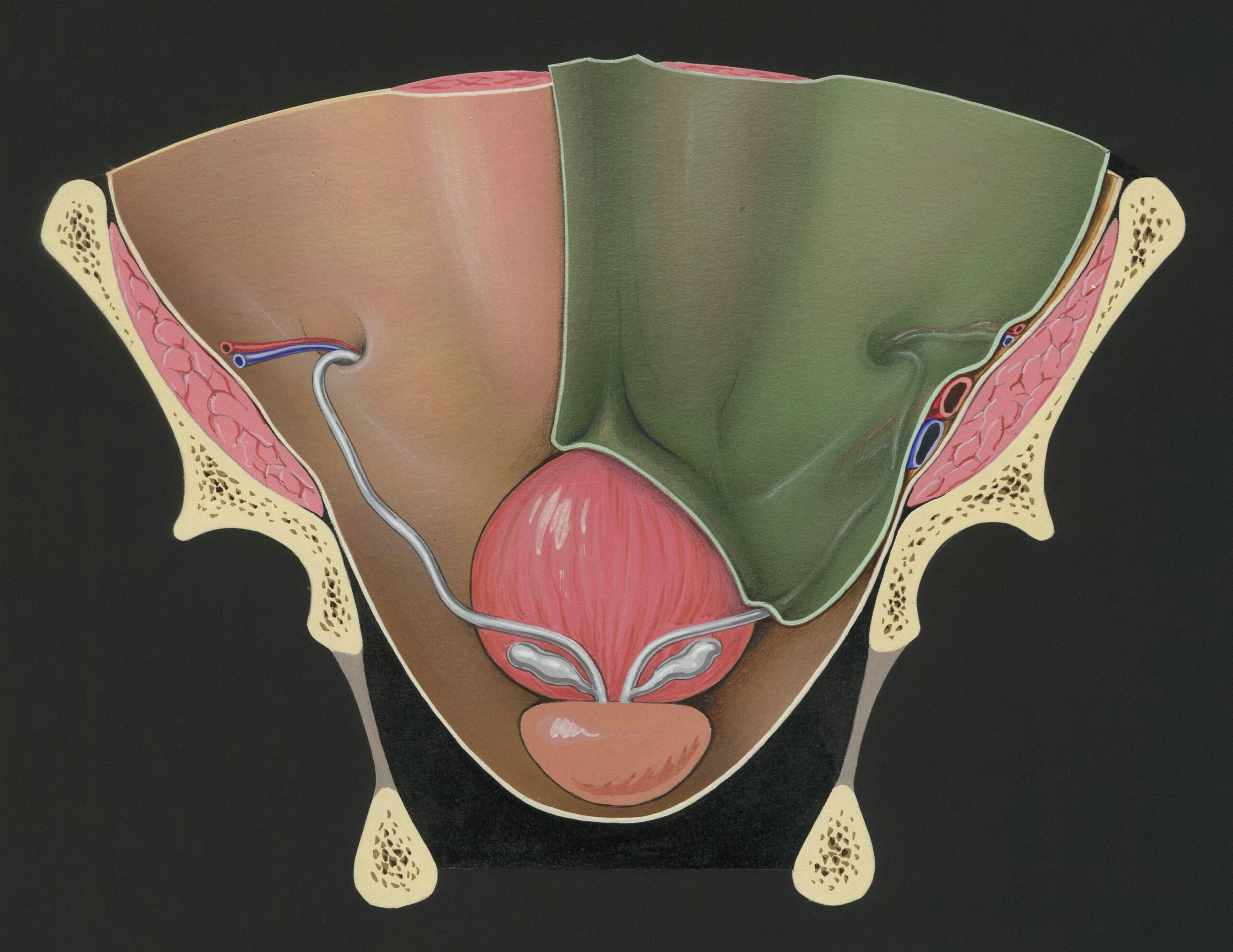 Prostate Cancer Screening